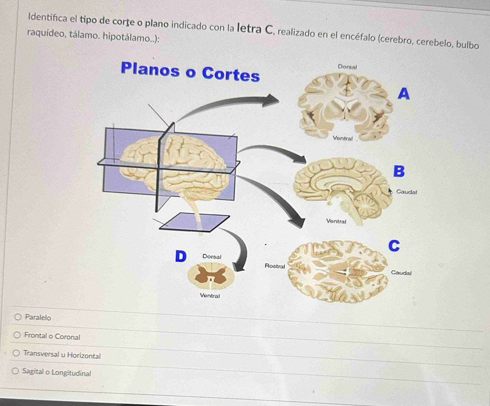 Identifica el tipo de corţe o plano indicado con la letra C, realizado en el encéfalo (cerebro, cerebelo, bulbo
raquídeo, tálamo. hipotálamo..):
_
Paralelo
Frontal o Coronal
_
Transversal u Horizontal
_
Sagital o Longitudinal
_