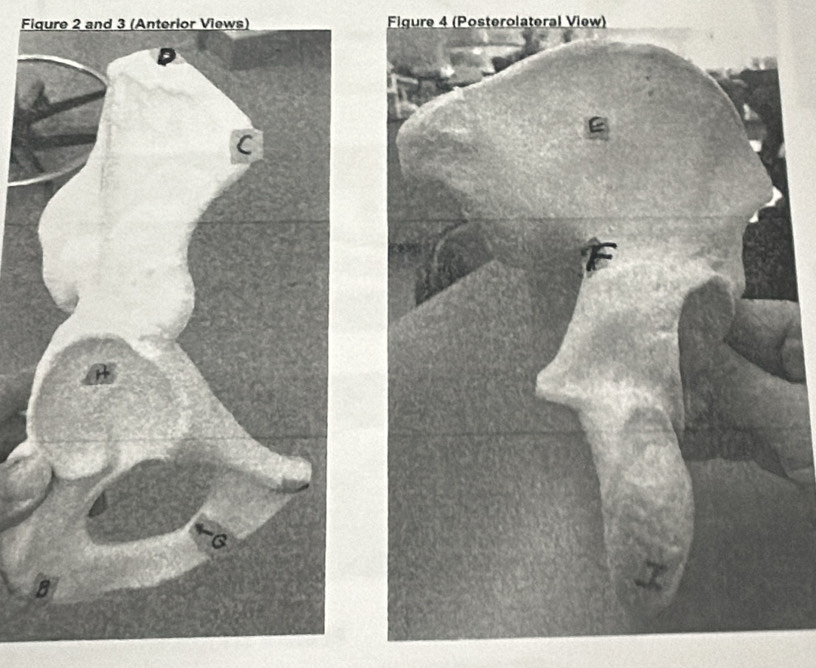 Fiqure 2 and 3 (Anterior Views) Figure 4 (Posterolateral View)