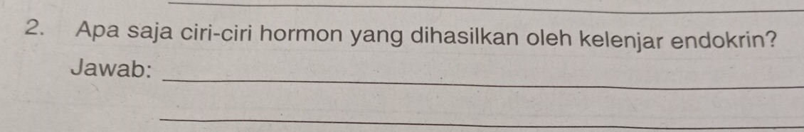 Apa saja ciri-ciri hormon yang dihasilkan oleh kelenjar endokrin? 
_ 
Jawab: 
_