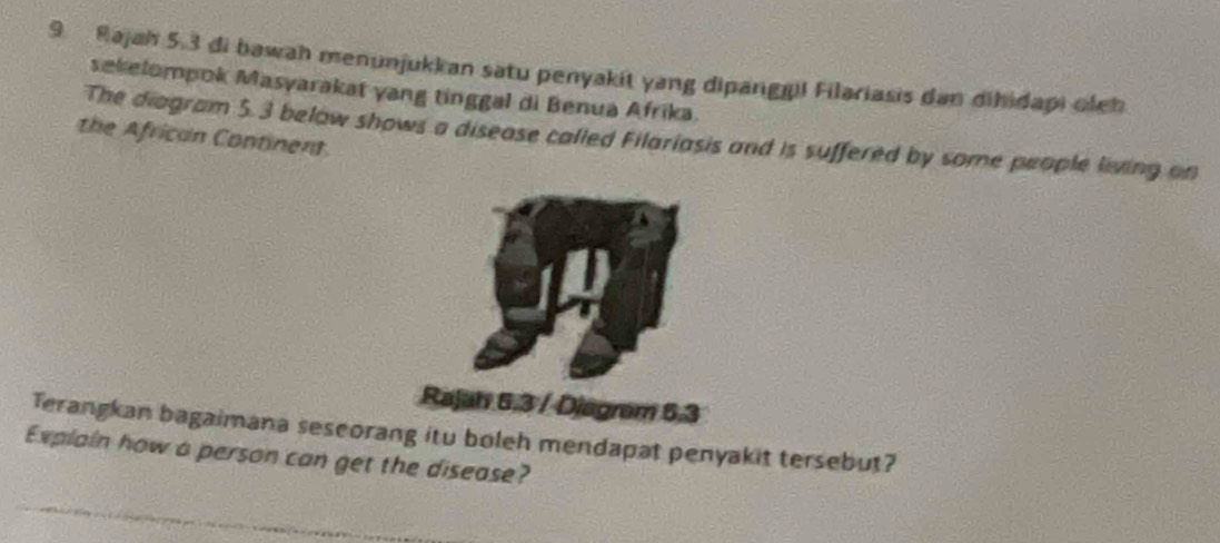 Rajah 5.3 di bawah menunjukkan satu penyakit yang dipargğil Filariasis dan dihidapi oleh 
sekelompok Masyarakat yang tinggal di Benua Afrika. 
The diagram 5.3 below shows a disease called Filariasis and is suffered by some people living on 
the African Continent. 
Rajah 5.3 / Djagram 5.3 
Terangkan bagaimana sescorang itu boleh mendapat penyakit tersebut? 
Explain how a person can get the disease?