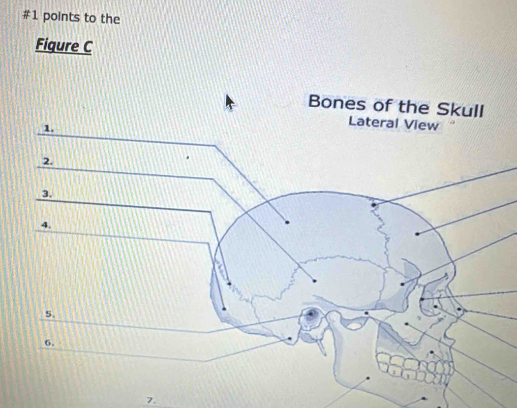 #1 points to the 
Figure C 
7.