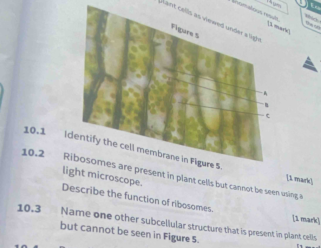 14μm Exa 
anomalous result 
Which 
plant cells as viewed under a ligh 
the oth 
[1 mark] 
10.1 I 
10.2 Ribosomes are present in plant cells but cannot be seen using a 
light microscope. 
[1 mark] 
Describe the function of ribosomes. 
[1 mark] 
10.3 Name one other subcellular structure that is present in plant cells 
but cannot be seen in Figure 5.