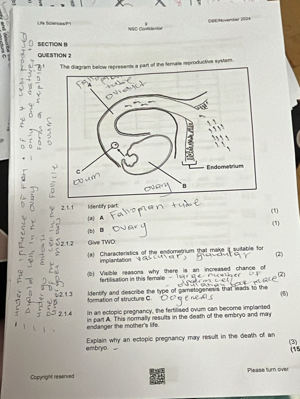 Life Sciences/P1 9 
DBE/November 2024 
NSC Confidential 
a SECTION B 
a 
QUESTION 2 
The diagram below represents a part of the female reproductive system. 
: 
2.1.1 Identify part: 
(a) A (1) 
(1) 
(b) B 
2.1.2 Give TWO: 
(a) Characteristics of the endometrium that make it suitable for 
implantation (2) 
(b) Visible reasons why there is an increased chance of 
(2) 
fertilisation in this female 
ψ2.1.3 Identify and describe the type of gametogenesis that leads to the 
(6) 
formation of structure C. 
2.1.4 In an ectopic pregnancy, the fertilised ovum can become implanted 
in part A. This normally results in the death of the embryo and may 
endanger the mother's life. 
Explain why an ectopic pregnancy may result in the death of an 
(3) 
embryo. (15 
Copyright reserved Please turn over