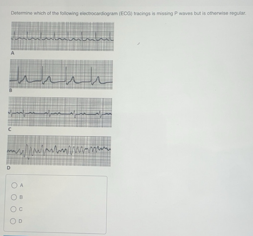 Solved: Determine which of the following electrocardiogram (ECG ...