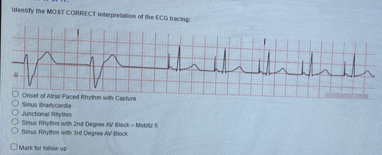 ldentify the MOST CORRECT interpretation of the ECG tracing:
Onset of Atrial Paced Rhythm with Capture
Sinus Bradycardia
Junctional Rhythm
Sinus Rhythm with 2nd Degree AV Block - Mobitz II
Sinus Rhythm with 3rd Degree AV Block
Mark for follow up