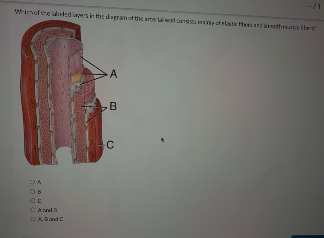 Solved: Which of the labeled layers in the diagram of the arterial wall ...