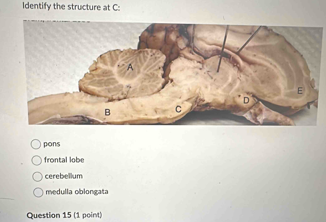 Identify the structure at C :
pons
frontal lobe
cerebellum
medulla oblongata
Question 15 (1 point)