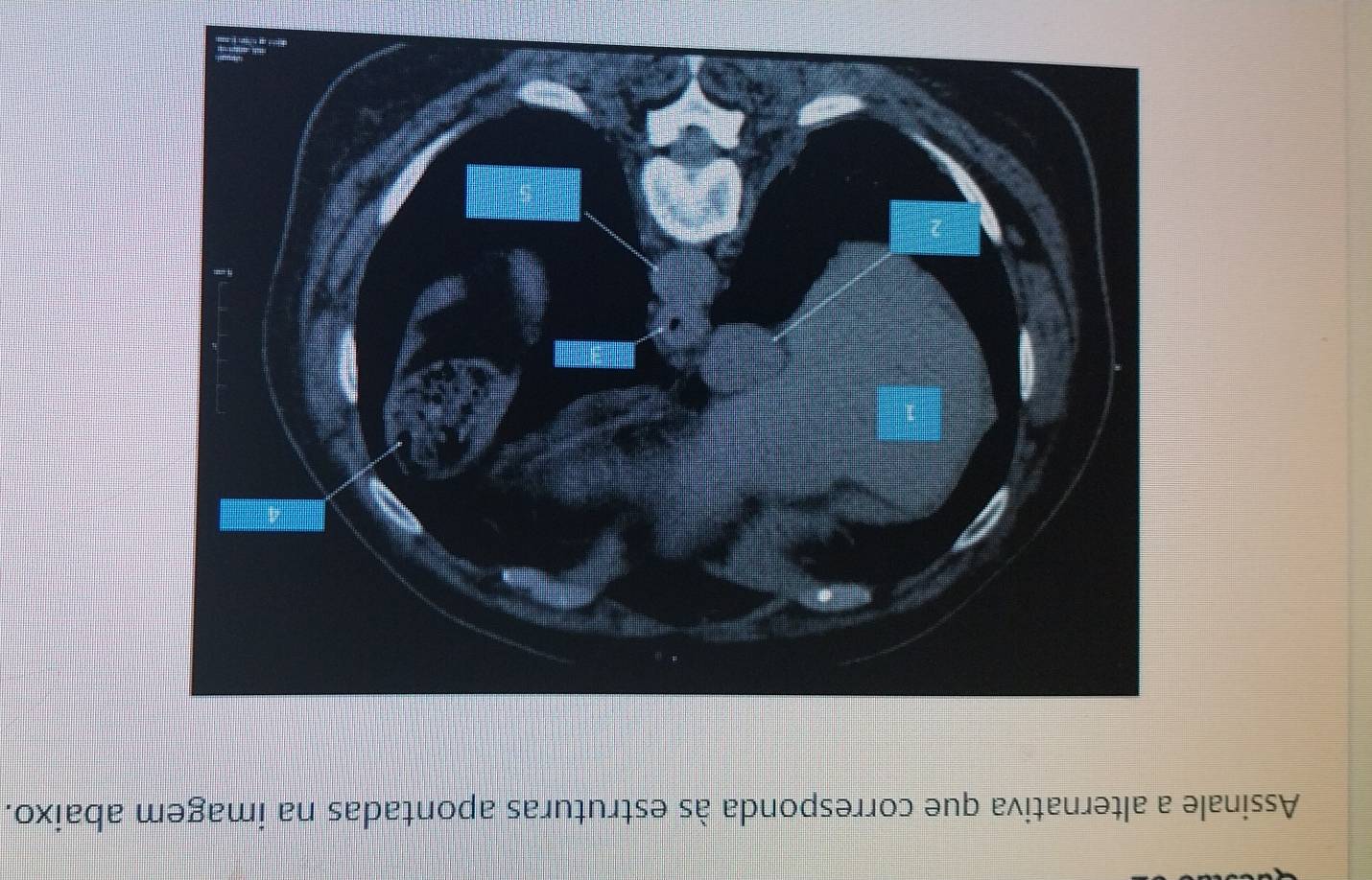 Assinale a alternativa que corresponda às estruturas apontadas na imagem abaixo.