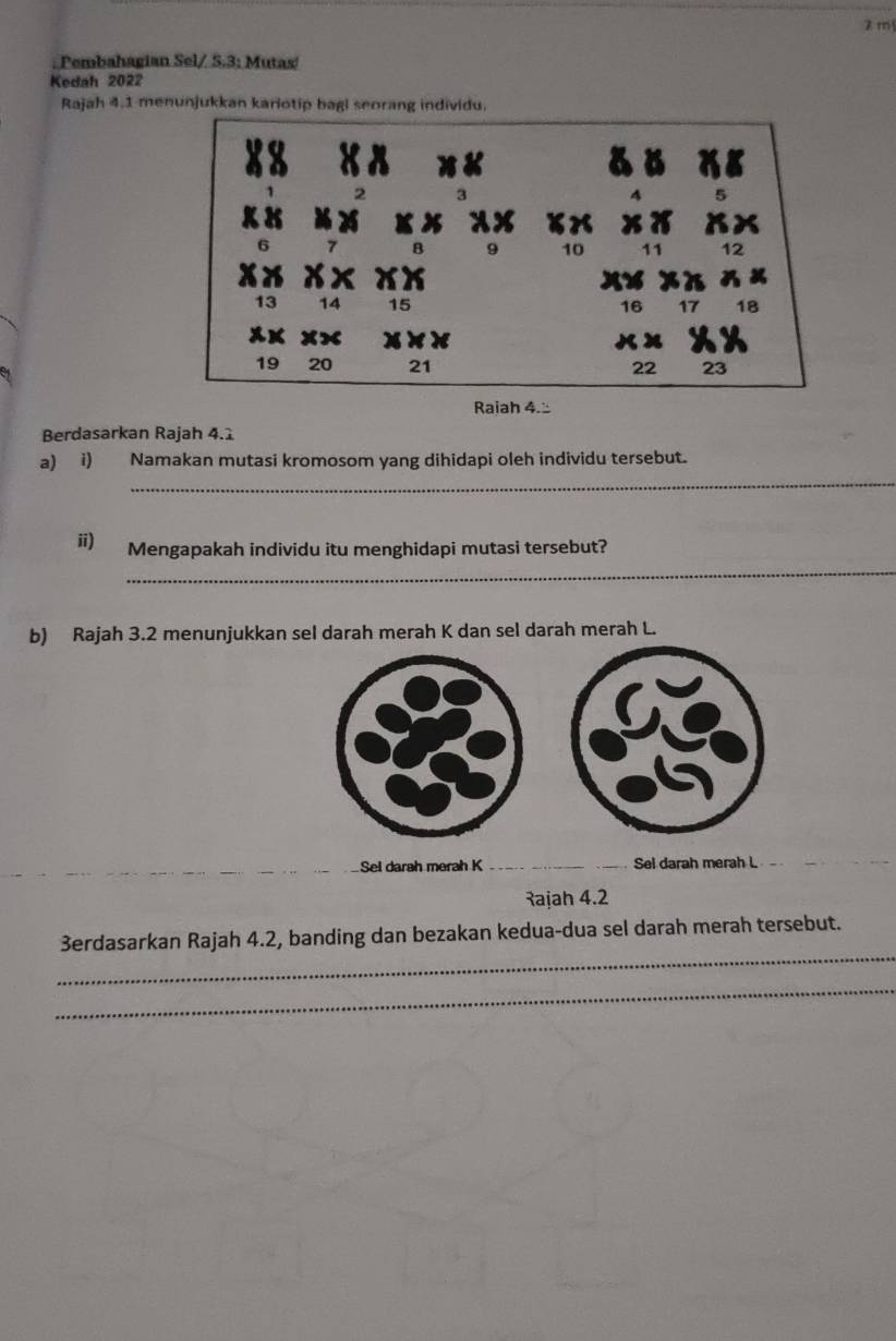 2 m. Pembahagian Sel/ S. 3; Mutas! 
Kedah 2022 
Rajah 4.1 menunjukkan kariotip bagi seorang individu.
x
10 11 12
13 14 15 16 17 18
19 20 21 22 23
Raiah 4.≌ 
Berdasarkan Rajah 4.1 
_ 
a) i) Namakan mutasi kromosom yang dihidapi oleh individu tersebut. 
_ 
ii) Mengapakah individu itu menghidapi mutasi tersebut? 
b) Rajah 3.2 menunjukkan sel darah merah K dan sel darah merah L. 
Sel darah merah K __Sel darah merah L
Rajah 4.2 
_ 
3erdasarkan Rajah 4.2, banding dan bezakan kedua-dua sel darah merah tersebut. 
_
