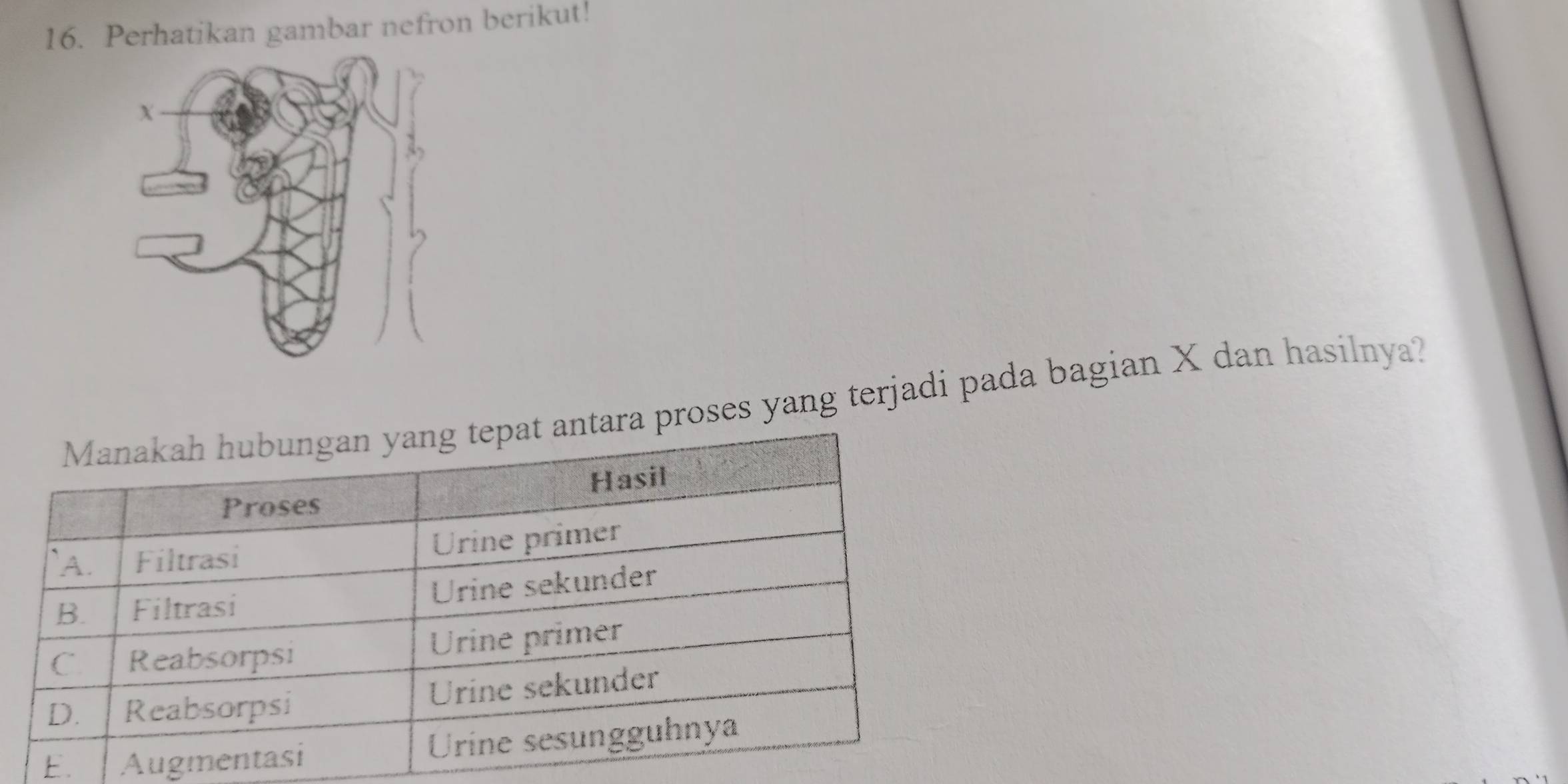 Perhatikan gambar nefron berikut! 
ra proses yang terjadi pada bagian X dan hasilnya? 
E.