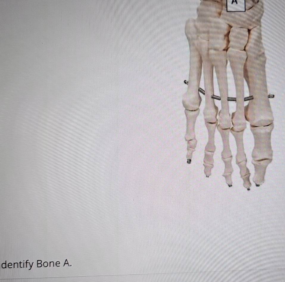 dentify Bone A.