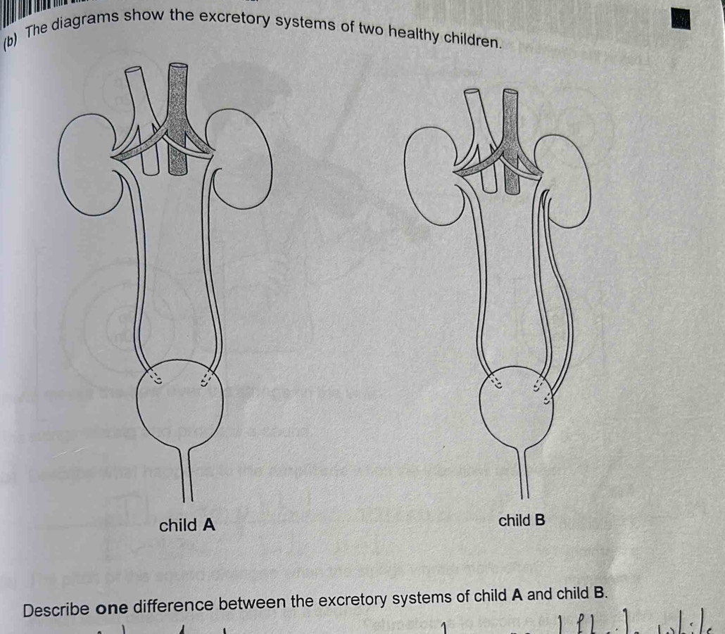 The diagrams show the excretory systems of two healthy children. 

Describe one difference between the excretory systems of child A and child B.