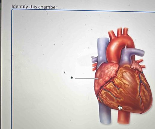 Identify this chamber.