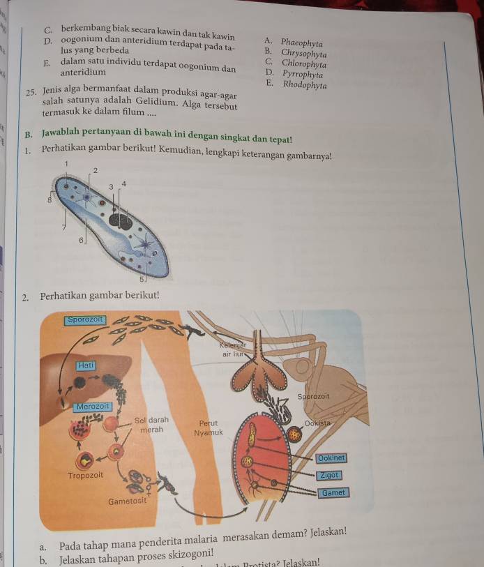 C. berkembang biak secara kawin dan tak kawin A. Phaeophyta
lus yang berbeda
D. oogonium dan anteridium terdapat pada ta B. Chrysophyta C. Chlorophyta
E. dalam satu individu terdapat oogonium dan D. Pyrrophyta
anteridium
E. Rhodophyta
25. Jenis alga bermanfaat dalam produksi agar-agar
salah satunya adalah Gelidium. Alga tersebut
termasuk ke dalam filum ....
B. Jawablah pertanyaan di bawah ini dengan singkat dan tepat!
1. Perhatikan gambar berikut! Kemudian, lengkapi keterangan gambarnya!
2. Perhatikan gambar berikut!
a. Pada tahap mana penderita malaria merasaka
b. Jelaskan tahapan proses skizogoni!
Dratista? Jelaskan!