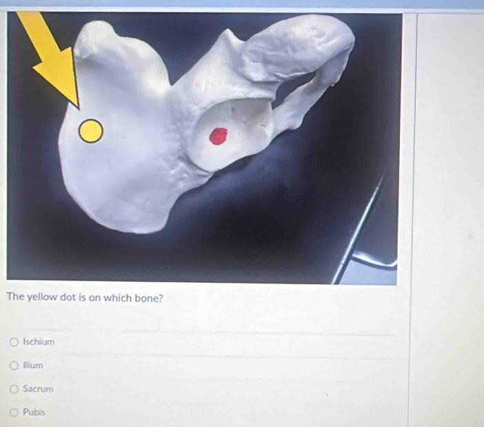 Ischium
Ilium
Sacrum
Pubis