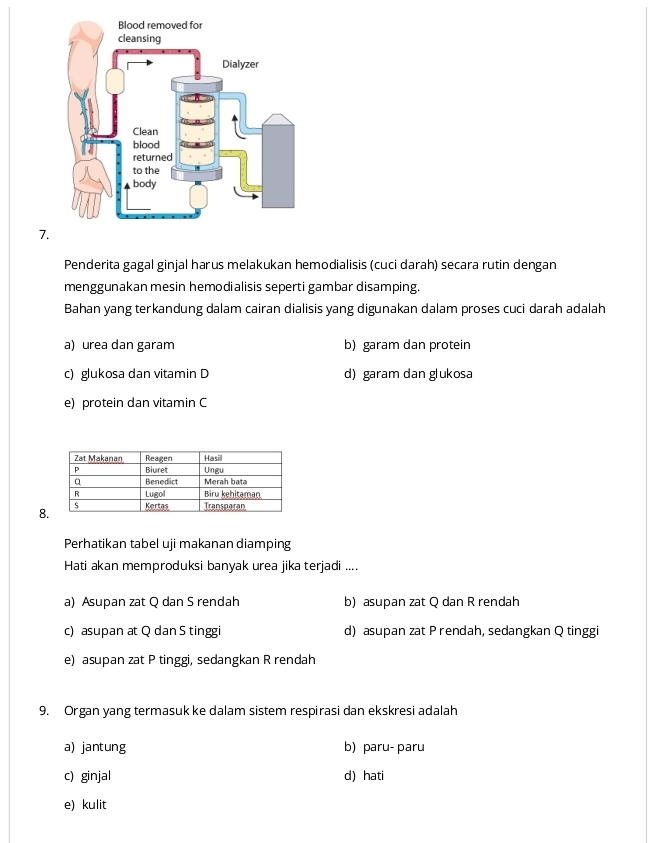 Penderita gagal ginjal harus melakukan hemodialisis (cuci darah) secara rutin dengan
menggunakan mesin hemodialisis seperti gambar disamping.
Bahan yang terkandung dalam cairan dialisis yang digunakan dalam proses cuci darah adalah
a) urea dan garam b) garam dan protein
c) glukosa dan vitamin D d) garam dan glukosa
e) protein dan vitamin C
8
Perhatikan tabel uji makanan diamping
Hati akan memproduksi banyak urea jika terjadi ....
a) Asupan zat Q dan S rendah b) asupan zat Q dan R rendah
c) asupan at Q dan S tinggi d) asupan zat Prendah, sedangkan Q tinggi
e) asupan zat P tinggi, sedangkan R rendah
9. Organ yang termasuk ke dalam sistem respirasi dan ekskresi adalah
a) jantung b)paru- paru
c) ginjal d) hati
e) kulit