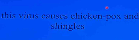 this virus causes chicken-pox and 
shingles