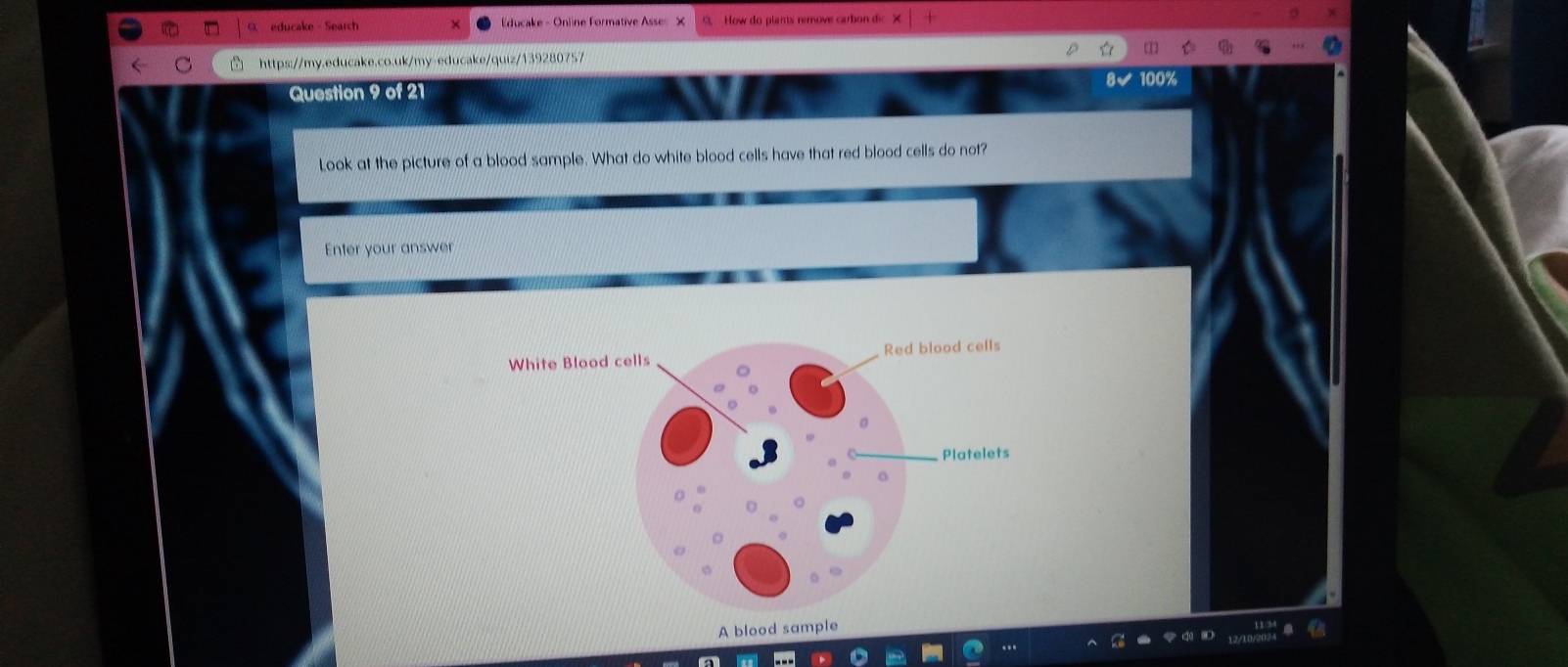 educake - Search Educake - Online Formative Asse 1 How do plants remove carbon di 
https://my.educake.co.uk/my-educake/quiz/139280757 
Question 9 of 21 
Look at the picture of a blood sample. What do white blood cells have that red blood cells do not? 
Enter your answer