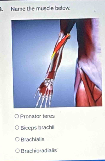 Name the muscle below.
Pronator teres
Biceps brachii
Brachialis
Brachioradialis