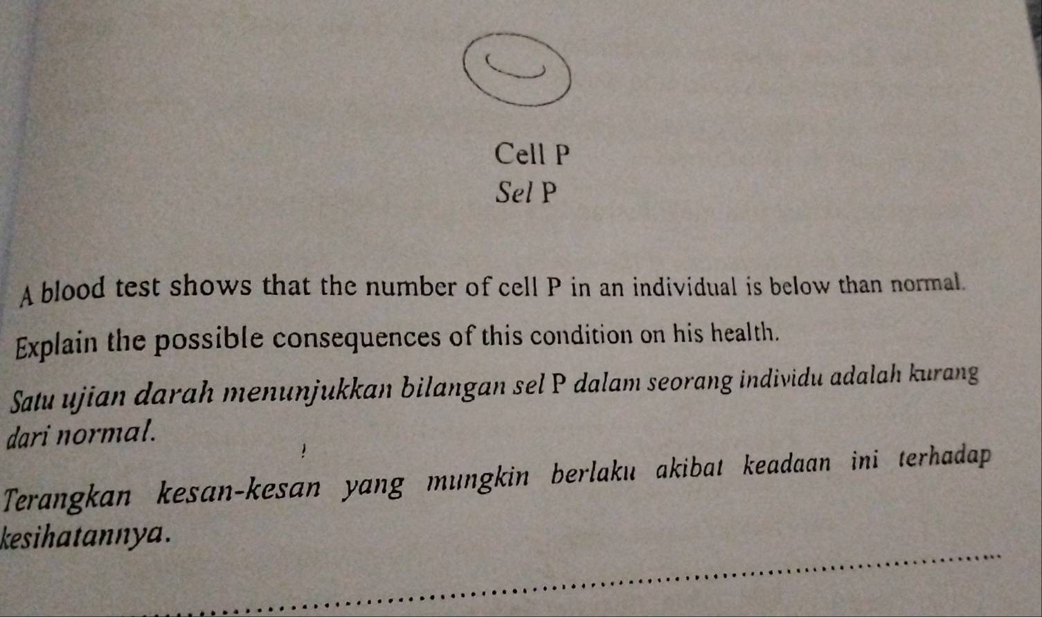 Cell P
Sel P 
A blood test shows that the number of cell P in an individual is below than normal. 
Explain the possible consequences of this condition on his health. 
Satu ujian darah menunjukkan bilangan sel P dalam seorang individu adalah kurang 
dari normal. 
Terangkan kesan-kesan yang mungkin berlaku akibat keadaan ini terhadap 
kesihatannya.