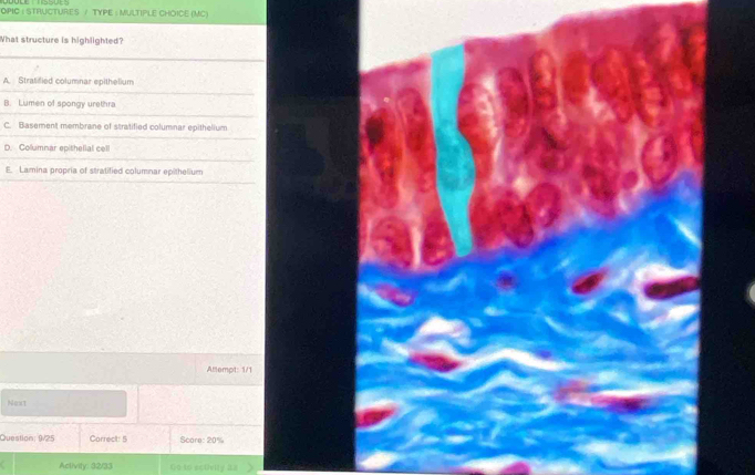 OPIC : STRUCTURES / TYPE : MULTIPLE CHOICE (MC)
What structure is highlighted?
A. Stratified columnar epithelium
B. Lumen of spongy urethra
C. Basement membrane of stratified columnar epithelium
D Columnar epithelial cell
E. Lamina propria of stratified columnar epithelium
Atlempt: 1/1
Next
Question; 9/25 Correct: 5 Scare: 20%
Aclivity: 32/33 Go to sctvlly as