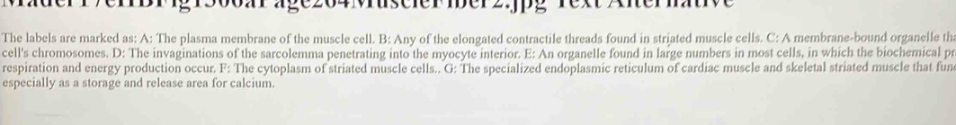 eiBFigr500aräge204Muscier ber2.jpg rext A
The labels are marked as: A: The plasma membrane of the muscle cell. B: Any of the elongated contractile threads found in striated muscle cells. C: A membrane-bound organelle th
cell's chromosomes. D: The invaginations of the sarcolemma penetrating into the myocyte interior. E: An organelle found in large numbers in most cells, in which the biochemical pr
respiration and energy production occur. F: The cytoplasm of striated muscle cells.. G: The specialized endoplasmic reticulum of cardiac muscle and skeletal striated muscle that fun
especially as a storage and release area for calcium.