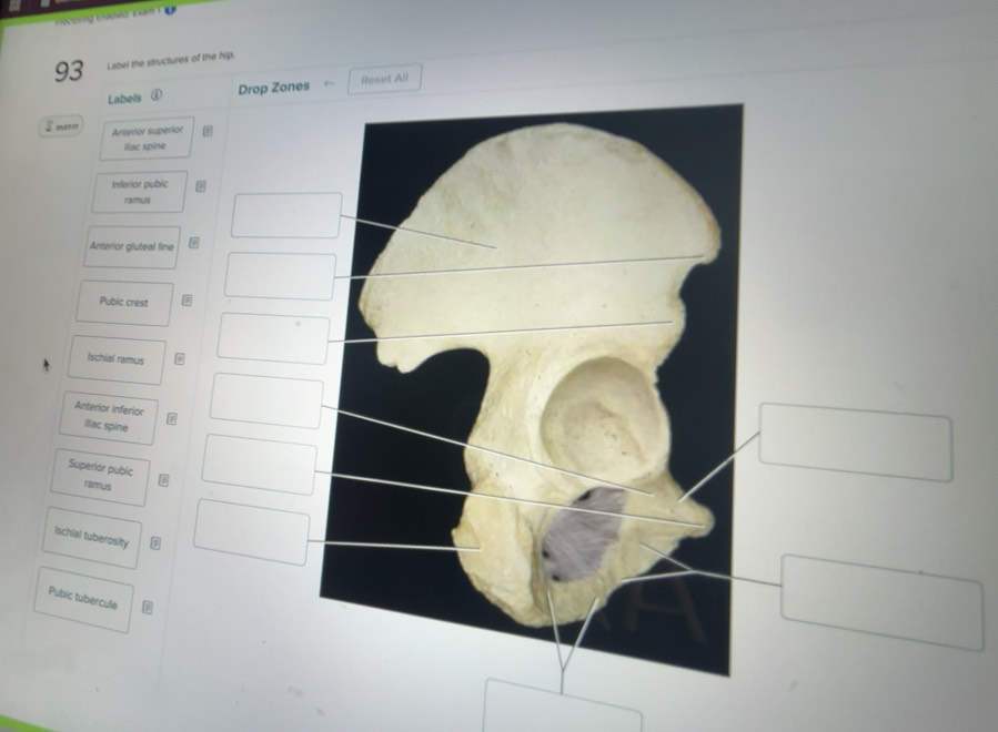 Solved: Label the structures of the hip. Labels ① Drop Zones Reset All ...
