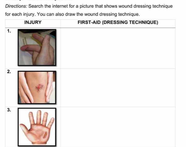 Directions: Search the internet for a picture that shows wound dressing technique 
for each injury. You can also draw the wound dressing technique.