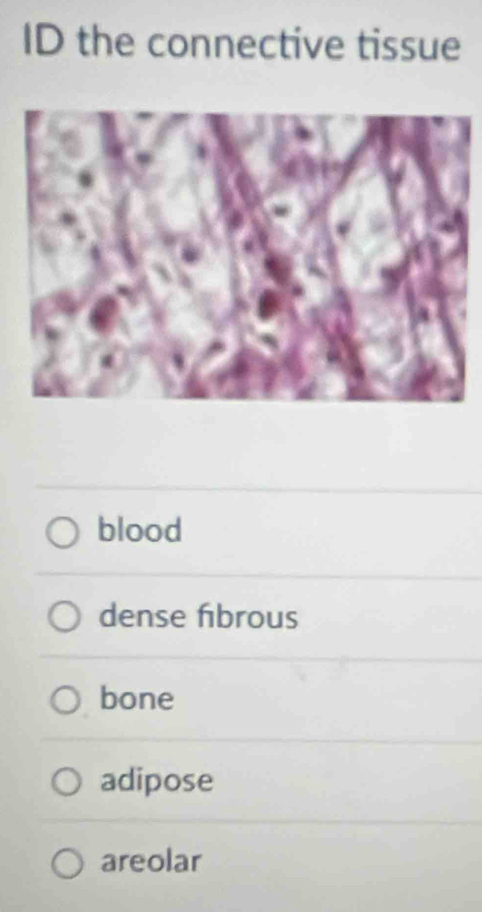 ID the connective tissue
blood
dense fbrous
bone
adipose
areolar