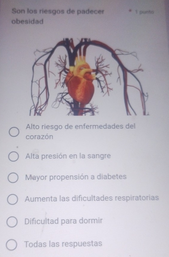 Son los riesgos de padecer 1 punto
obesidad
Alto riesgo de enfermedades del
corazón
Alta presión en la sangre
Mayor propensión a diabetes
Aumenta las dificultades respiratorias
Dificultad para dormir
Todas las respuestas