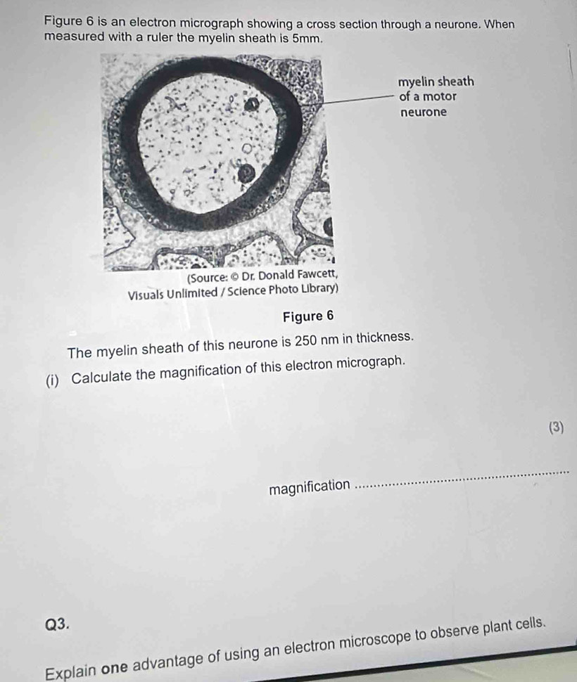 Figure 6 is an electron micrograph showing a cross section through a neurone. When 
measured with a ruler the myelin sheath is 5mm. 
Figure 6 
The myelin sheath of this neurone is 250 nm in thickness. 
(i) Calculate the magnification of this electron micrograph. 
(3) 
magnification 
_ 
Q3. 
Explain one advantage of using an electron microscope to observe plant cells.