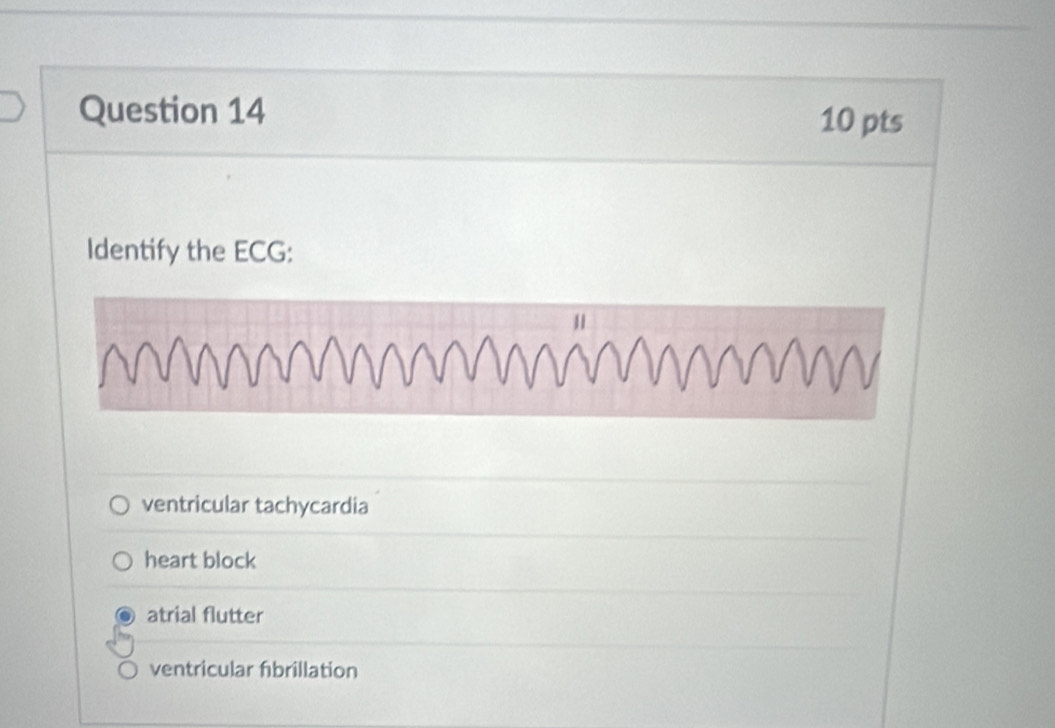 Identify the ECG:
ventricular tachycardia
heart block
atrial flutter
ventricular fibrillation