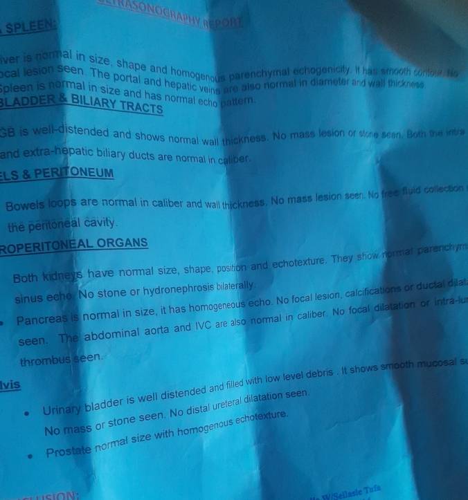 LTRASONOGRAPHY REPORT 
SPLEEN: 
ver is normal in size, shape and homogenous parenchymal echogenicity. It has smooth contou he 
cal lesion seen. The portal and hepatic veing are also normal in diameter and wall thicknese 
spleen is normal in size and has normal echo pattern. 
BLADDER & BILIARY TRACTS 
GB is well-distended and shows normal wall thickness. No mass lesion or stone seen. Both the intra 
and extra-hepatic biliary ducts are normal in caliber. 
LS & PERITONEUM 
Bowels loops are normal in caliber and wall thickness. No mass lesion seen. No free fluid collection 
the peritoneal cavity. 
ROPERITONEAL ORGANS 
Both kidneys have normal size, shape, position and echotexture. They show normal parenchym 
sinus echo. No stone or hydronephrosis bilaterally. 
Pancreas is normal in size, it has homogeneous echo. No focal lesion, calcifications or ductal dilat 
seen. The abdominal aorta and IVC are also normal in caliber. No focal dilatation or intra-lu 
thrombus seen. 
Ivis 
Urinary bladder is well distended and filled with low level debris . It shows smooth mucosal s 
No mass or stone seen. No distal ureferal dilatation seen. 
Prostate normal size with homogenous echotexture. 
la W/Seilasie Tuía