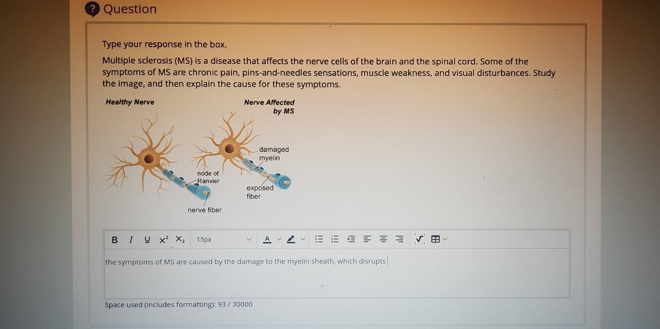 Question 
Type your response in the box. 
Multiple sclerosis (MS) is a disease that affects the nerve cells of the brain and the spinal cord. Some of the 
symptoms of MS are chronic pain, pins-and-needles sensations, muscle weakness, and visual disturbances. Study 
the image, and then explain the cause for these symptoms. 
B I U 15px 
the symptoms of MS are caused by the damage to the myelin sheath, which disrupts 
Space used (includes formatting): 93 / 30000