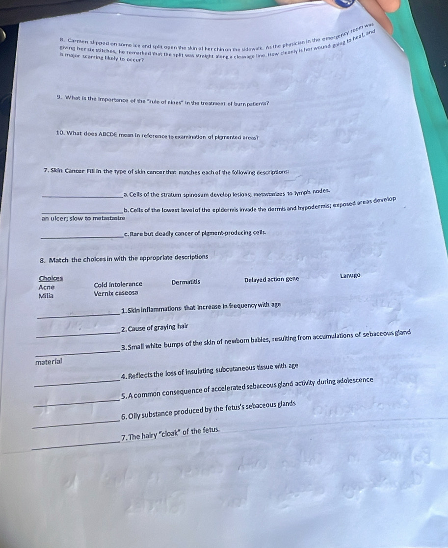 Carmen slipped on some ice and split open the skin of her chin on the sidewalk. As the physician in the emergency room was
giving her six stitches, he remarked that the split was straight along a cleavage line. How cleanly is her wound going to heal, and
is major scarring likely to occur?
9. What is the importance of the “rule of nines” in the treatment of burn patients?
10. What does ABCDE mean in reference to examination of pigmented areas?
7. Skin Cancer Fill in the type of skin cancer that matches each of the following descriptions:
_a. Cells of the stratum spinosum develop lesions; metastasizes to lymph nodes.
_an ulcer; slow to metastasize b. Cells of the lowest level of the epidermis invade the dermis and hypodermis; exposed areas develop
_c. Rare but deadly cancer of pigment-producing cells.
8. Match the choices in with the appropriate descriptions
Choices
Acne Cold Intolerance Dermatitis Delayed action gene Lanugo
Milia Vernix caseosa
_
1. Skin inflammations that increase in frequency with age
2. Cause of graying hair
_
_3.Small white bumps of the skin of newborn bables, resulting from accumulations of sebaceous gland
material
4. Reflects the loss of insulating subcutaneous tissue with age
_
_5. A common consequence of accelerated sebaceous gland activity during adolescence
_
6. Olly substance produced by the fetus's sebaceous glands
_
7. The hairy “cloak” of the fetus.