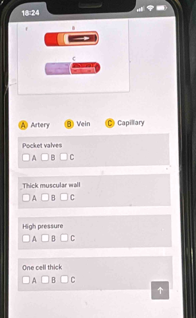 18:24
B
C
A Artery B Vein C Capillary
Pocket valves
A B a
Thick muscular wall
A B
High pressure
A B C
One cell thick
A B C