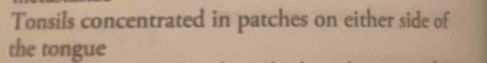 Tonsils concentrated in patches on either side of 
the tongue