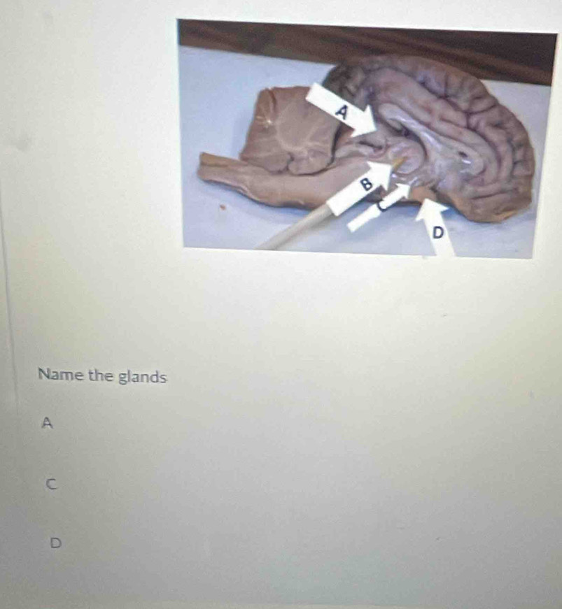 Name the glands
A
C
D