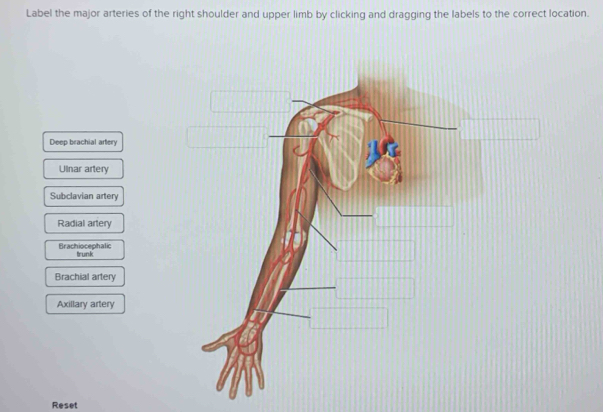 Solved: Label the major arteries of the right shoulder and upper limb ...