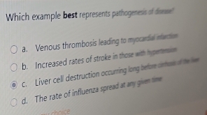 Which example best represents pathogenesis of disne!
a. Venous thrombosis leading to myocardial infanction
b. Increased rates of stroke in those with hypertension
c. Liver cell destruction occurring long before crhow of the hv
d. The rate of influenza spread at any given time