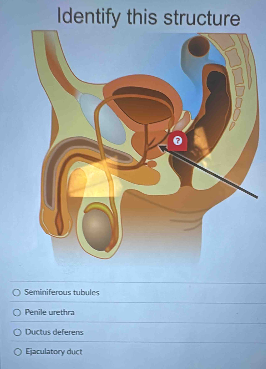 Identify this structure
Seminiferous tubules
Penile urethra
Ductus deferens
Ejaculatory duct