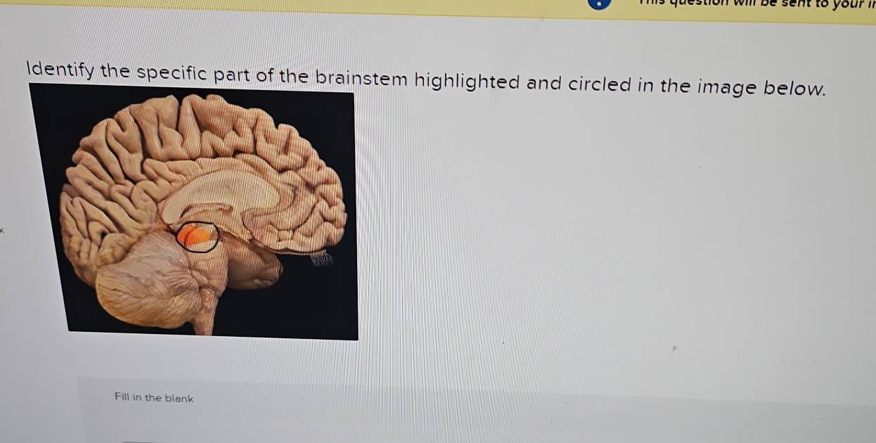 will be sent to your ' . 
ldentify the specific part of the brainstem highlighted and circled in the image below. 
Fill in the blank