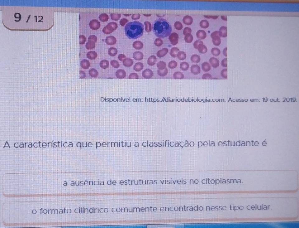 9 / 12
Disponível em: https://diariodebiologia.com. Acesso em: 19 out. 2019.
A característica que permitiu a classificação pela estudante é
a ausência de estruturas visíveis no citoplasma.
o formato cilíndrico comumente encontrado nesse tipo celular.