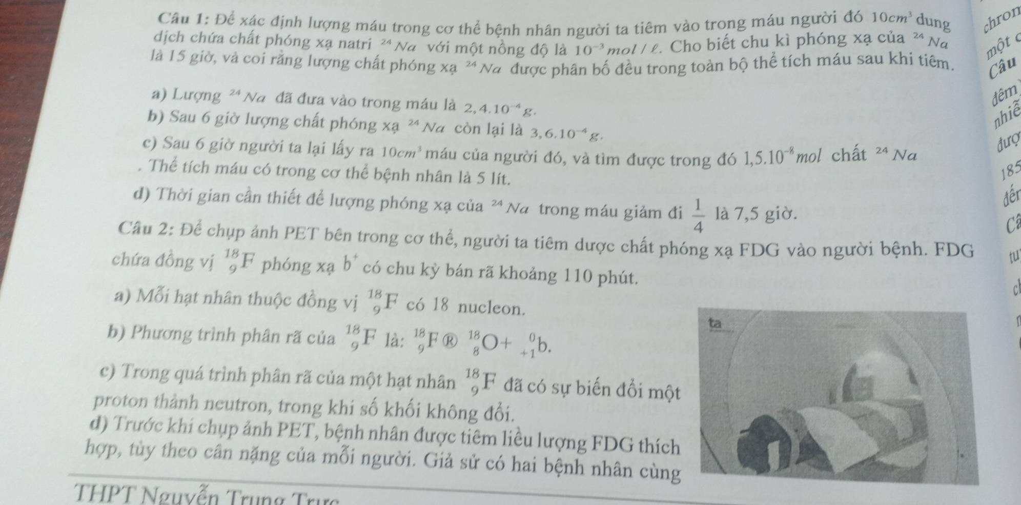 Cầu 1: Để xác định lượng máu trong cơ thể bệnh nhân người ta tiêm vào trong máu người đó 10cm^3 dung chron
dịch chứa chất phóng xạ natri ²* Na với một nồng độ là 10^(-3) m ol/ell. Cho biết chu kì phóng xạ của Na một c
là 15 giờ, và coi rằng lượng chất phóng Xa^(24) Na được phân bố đều trong toàn bộ thể tích máu sau khi tiêm. Câu
đêm
a) Lượng ' Na đã đưa vào trong máu là 2,4.10^(-4)g.
nhiễ
b) Sau 6 giờ lượng chất phóng x a 24 Na còn lại là 3,6.10^(-4)g.
c) Sau 6 giờ người ta lại lấy ra 10cm^3 máu của người đó, và tìm được trong đó 1,5.10^(-8) mol chất 24 Na
đượ
. Thể tích máu có trong cơ thể bệnh nhân là 5 lít.
185
đếr
d) Thời gian cần thiết để lượng phóng xạ của 24. Na trong máu giảm đi  1/4  là 7,5 giờ. C
Cầu 2: Để chụp ảnh PET bên trong cơ thể, người ta tiêm dược chất phóng xạ FDG vào người bệnh. FDG tu
chứa đồng vị _9^((18)F phóng xạ b^+) có chu kỳ bán rã khoảng 110 phút.
C
a) Mỗi hạt nhân thuộc đồng vị _9^(18)F có 18 nucleon.
b) Phương trình phân rã của _9^(18)F là: _9^(18)F _9^(18)F _8^(18)O+_(+1)^0b.
c) Trong quá trình phân rã của một hạt nhân _9^(18)F đã có sự biến đổi mộ
proton thành neutron, trong khi số khối không đổi.
d) Trước khi chụp ảnh PET, bệnh nhân được tiêm liều lượng FDG thích
hợp, tùy theo cân nặng của mỗi người. Giả sử có hai bệnh nhân cùng
THPT Nguyễn Trụng Trực