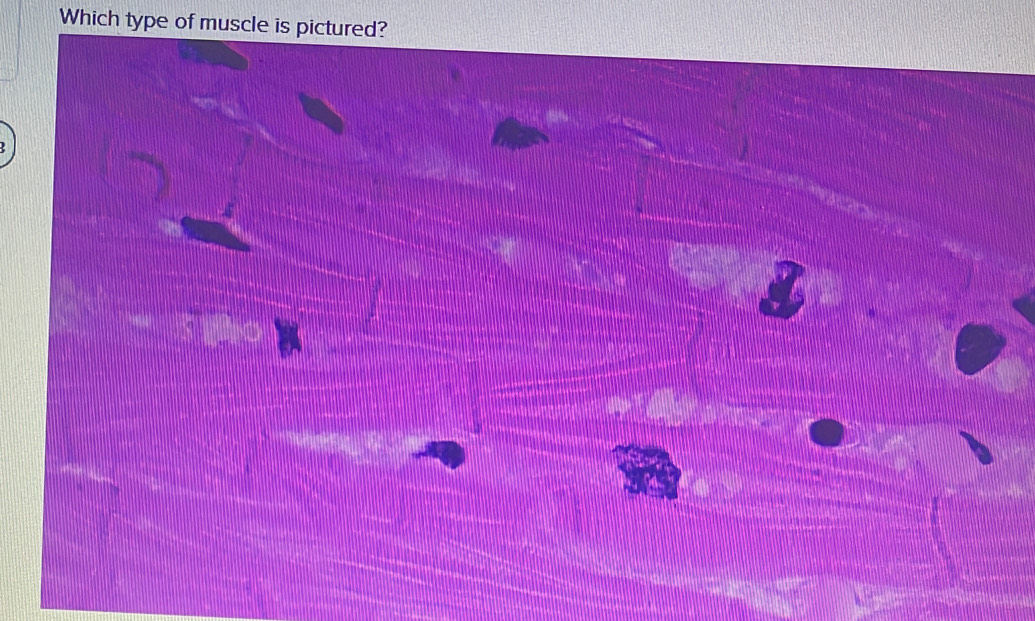 Which type of muscle is pictured? 
.