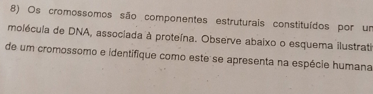 Os cromossomos são componentes estruturais constituídos por um 
molécula de DNA, associada à proteína. Observe abaixo o esquema ilustrati 
de um cromossomo e identifique como este se apresenta na espécie humana