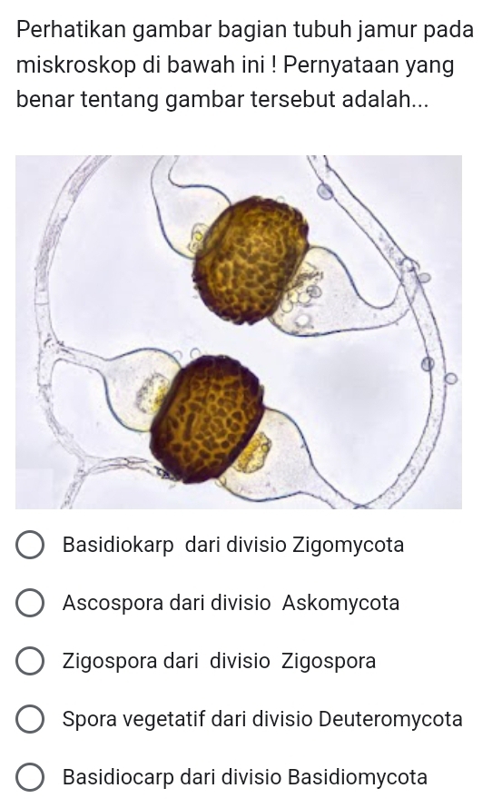 Perhatikan gambar bagian tubuh jamur pada
miskroskop di bawah ini ! Pernyataan yang
benar tentang gambar tersebut adalah...
Basidiokarp dari divisio Zigomycota
Ascospora dari divisio Askomycota
Zigospora dari divisio Zigospora
Spora vegetatif dari divisio Deuteromycota
Basidiocarp dari divisio Basidiomycota