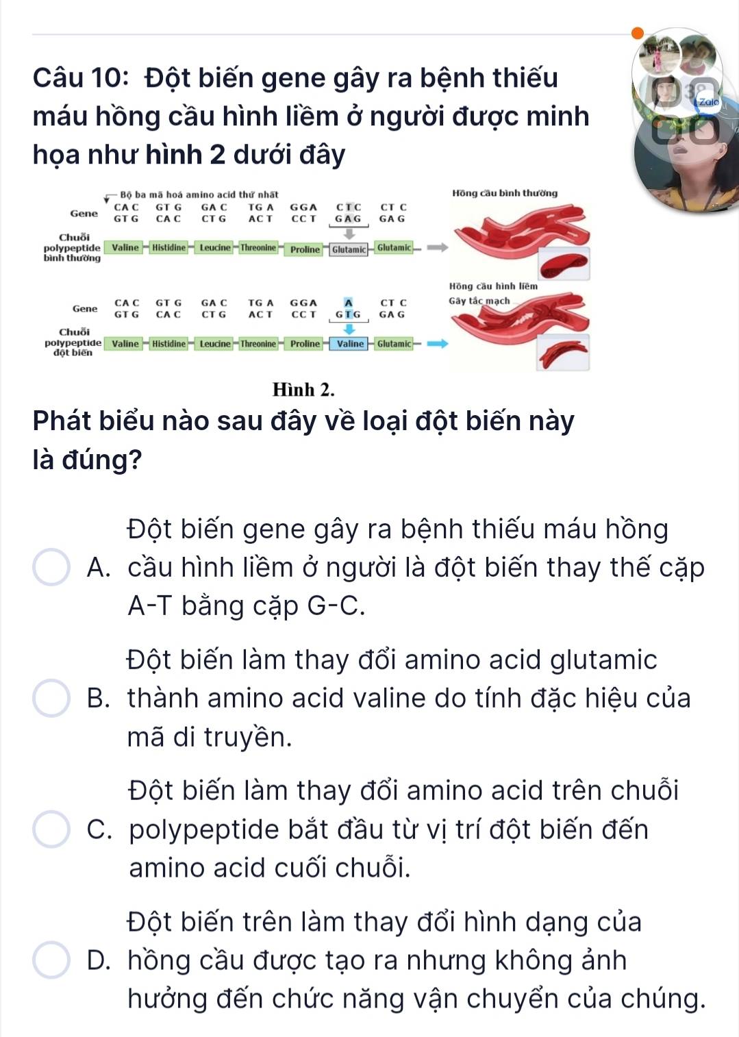 Đột biến gene gây ra bệnh thiếu
máu hồng cầu hình liềm ở người được minh
họa như hình 2 dưới đây
Hình 2.
Phát biểu nào sau đây về loại đột biến này
là đúng?
Đột biến gene gây ra bệnh thiếu máu hồng
A. cầu hình liềm ở người là đột biến thay thế cặp
A-T bằng cặp G-C.
Đột biến làm thay đổi amino acid glutamic
B. thành amino acid valine do tính đặc hiệu của
mã di truyền.
Đột biến làm thay đổi amino acid trên chuỗi
C. polypeptide bắt đầu từ vị trí đột biến đến
amino acid cuối chuỗi.
Đột biến trên làm thay đổi hình dạng của
D. hồng cầu được tạo ra nhưng không ảnh
hưởng đến chức năng vận chuyển của chúng.