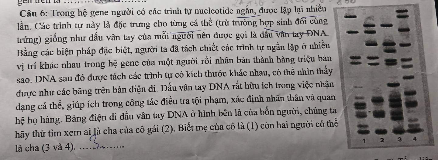 gen trên là 
Câu 6: Trong hệ gene người có các trình tự nucleotide ngắn, được lặp lại nhiều 
lần. Các trình tự này là đặc trưng cho từng cá thể (trừ trường hợp sinh đối cùng 
trứng) giống như dấu vân tay của mỗi người nên được gọi là dấu vân tay DNA. 
Bằng các biện pháp đặc biệt, người ta đã tách chiết các trình tự ngắn lặp ở nhiều 
vị trí khác nhau trong hệ gene của một người rỗi nhân bản thành hàng triệu bản 
sao. DNA sau đó được tách các trình tự có kích thước khác nhau, có thể nhìn thấy 
được như các băng trên bản điện di. Dấu vân tay DNA rất hữu ích trong việc nhận 
dạng cá thể, giúp ích trong công tác điều tra tội phạm, xác định nhân thân và quan 
hệ họ hàng. Bảng điện di dấu vân tay DNA ở hình bên là của bốn người, chúng ta 
thấy thử tìm xem ai là cha của cô gái (2). Biết mẹ của cô là (1) còn hai người có thể
1 2 3 4
là cha (3 và 4)._