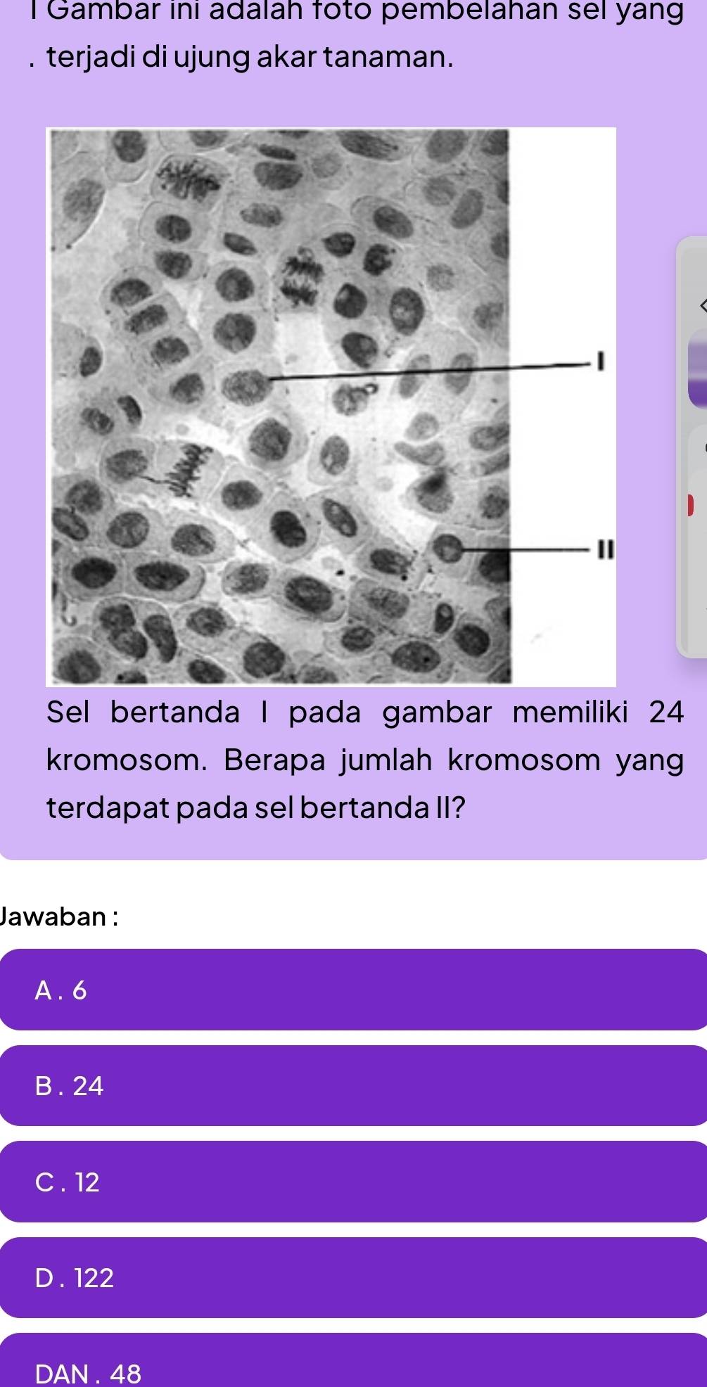 Gambar ini adalah foto pembelahán sel yang
terjadi di ujung akar tanaman.
Sel bertanda I pada gambar memiliki 24
kromosom. Berapa jumlah kromosom yang
terdapat pada sel bertanda II?
Jawaban :
A. 6
B . 24
C . 12
D . 122
DAN . 48